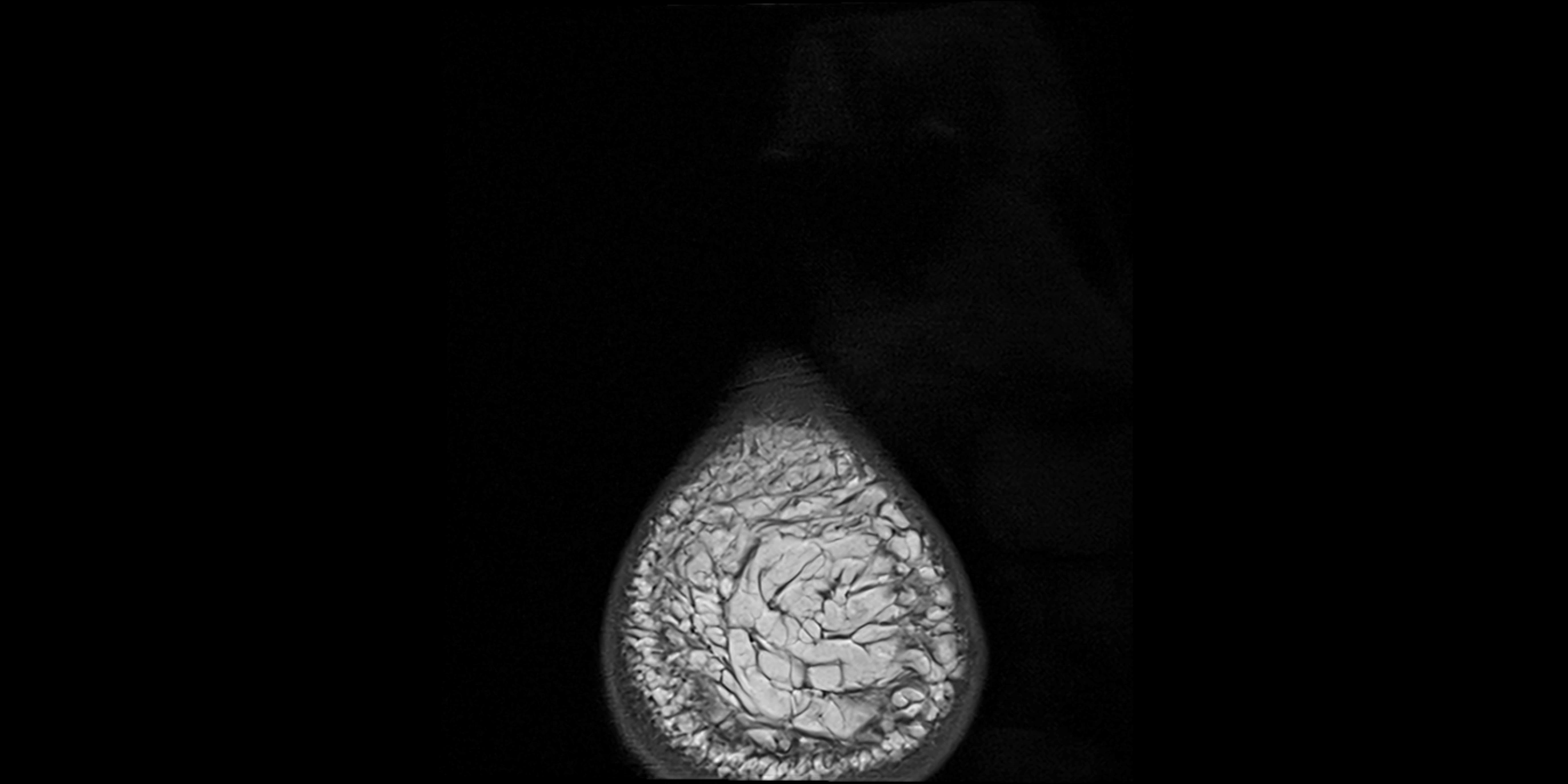 MRI Ankle coronal ligaments cross sectional anatomy 3T  radiology  image-img-00001-00034.webp